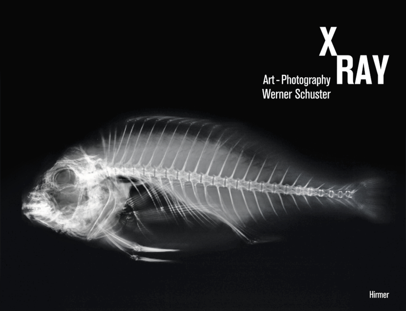 X-Ray